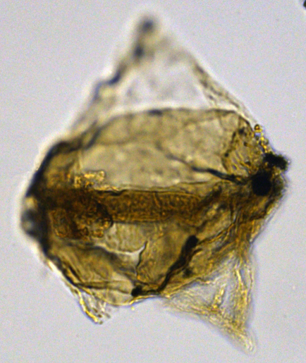 Cerodinium cpx cf wardenenseCward27X1001021001075a.jpg